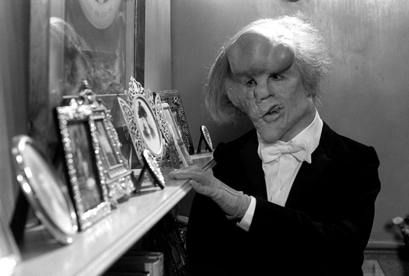 The Elephant Man (1980)